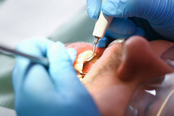 Best Broken or Chipped Tooth Repair in Cuero, TX